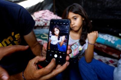 A Palestinian girl wears a bracelet to help identify her if she is killed in Israeli air strikes, at a shelter in Khan Younis, southern Gaza, on October 24. Reuters