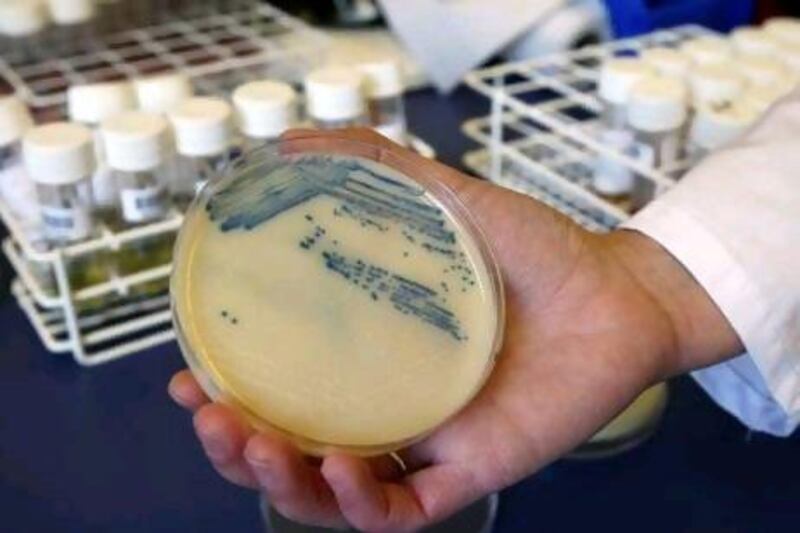 Shown here is a petri dish with methicillin-resistant Staphylococcus aureus (MSRA) cultures at the Queen Elizabeth Hospital in King's Lynn, England. Doctors are calling for urgent action on the spread of the superbug in UAE hospitals.