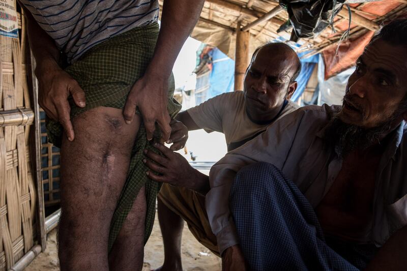 Salim Ullah, 26, displays the scars he says are from a bullet fired by a Myanmar soldier in August 2017. Camp 13, Cox's Bazar, Bangladesh, August 11 2018. Campbell MacDiarmid for The National