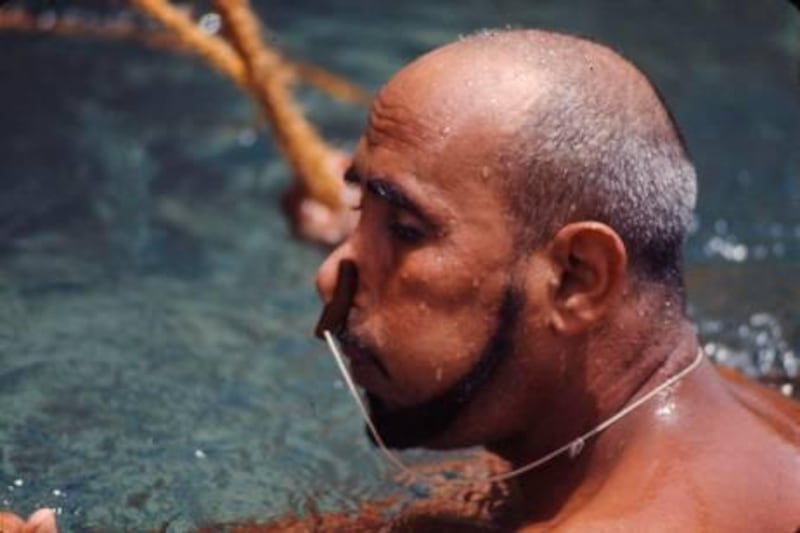 UAE. Image from the early 1970s showing a pearl diver wearing a nose plug.  

Photo by Alain Saint-Hilaire
alainsainthilaire@yahoo.ca
Request permssion to use this / discuss fees etc *** Karen  *** Local Caption *** EDS NOTE: Request permIsion to use this / discuss fees etc *** Karen 