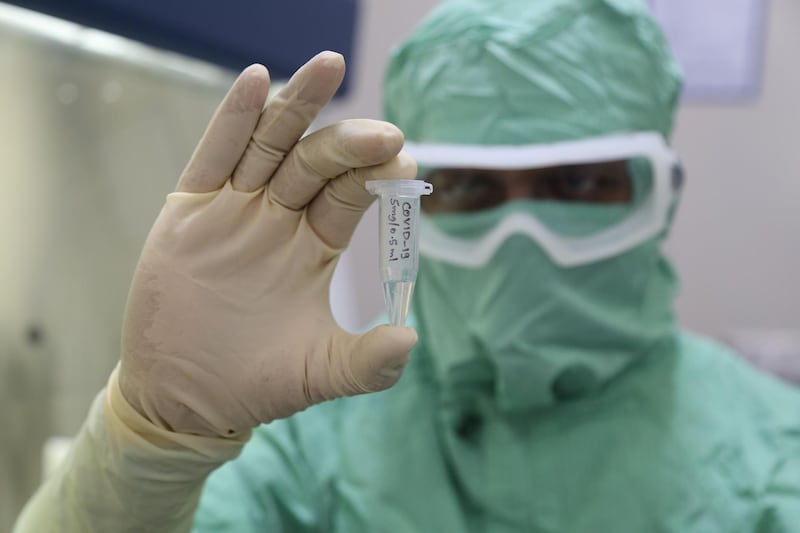 Indian pharmaceutical company Zydus Cadila’s ZyCov-D is among dozens of vaccine candidates being developed globally in the hunt to find an antidote for the coronavirus that has killed more than 1.3 million people. About 30,000 volunteers will receive injections in India next month in final stage trials. Courtesy 