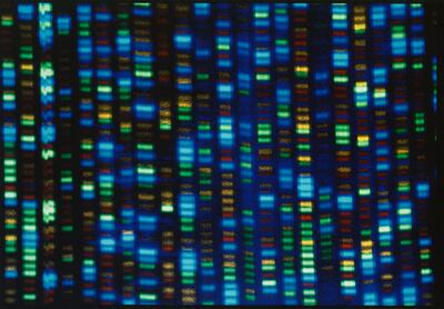 An image from the National Human Genome Research Institute shows the output from a DNA sequencer. AP