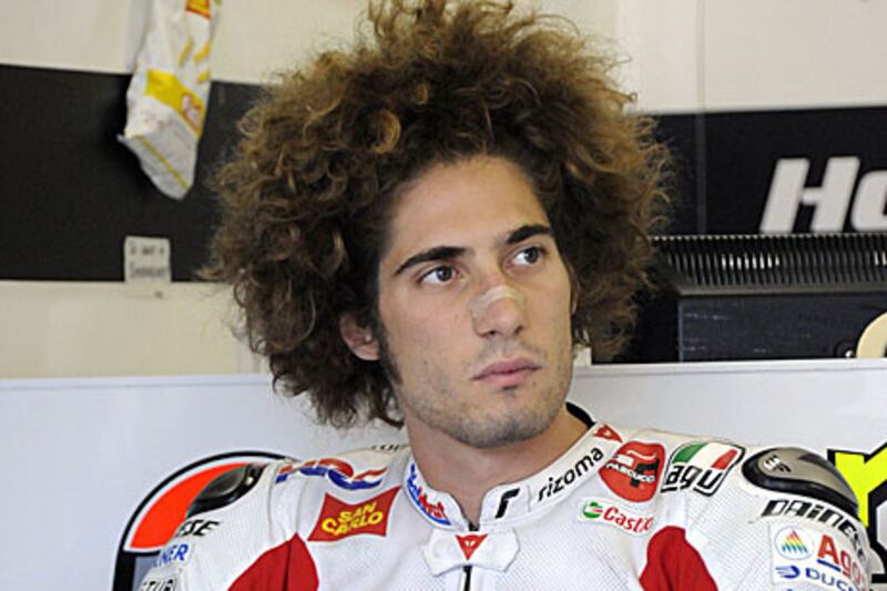 Marco Simoncelli died from his injuries sustained in Sepang after colliding with Colin Edwards and Valentino Rossi on Lap 2 of the Malyasian MotoGP.