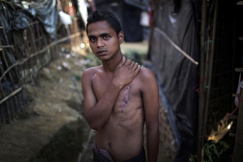 In this Friday Nov. 24, 2017, photo, Mohammadul Hassan, 18, is photographed outside his family's tent in Jamtoli refugee camp in Bangladesh. Hassan still bears the scars on his chest and back from being shot by soldiers who attempted to kill him. More than 650,000 Rohingya Muslims have fled to Bangladesh from Myanmar since August, and many have brought with them stories of atrocities committed by security forces in Myanmar, including an Aug. 27 army massacre that reportedly took place in the village of Maung Nu. (AP Photo/Wong Maye-E)