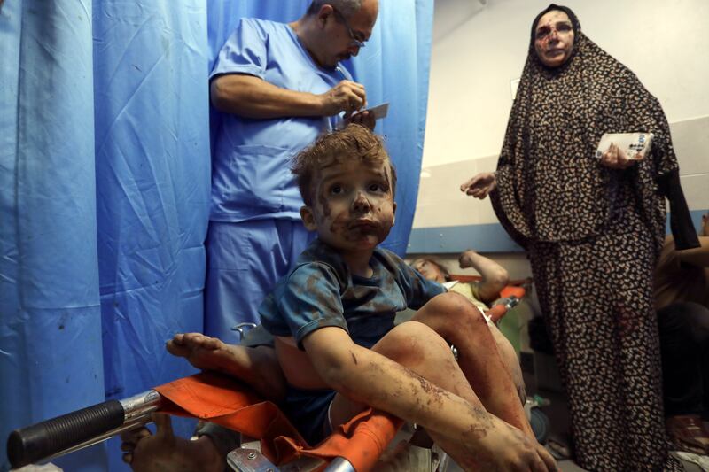 Wounded Palestinians receive treatment at Al Shifa hospital following Israeli air strikes on Gaza city. AP