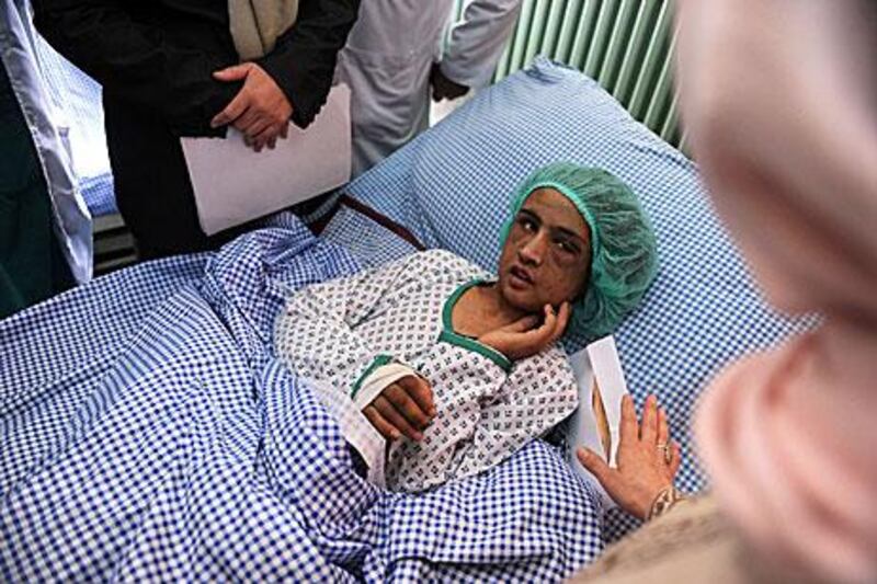Sahar Gul recovers in a Kabul hospital after being rescued last week.