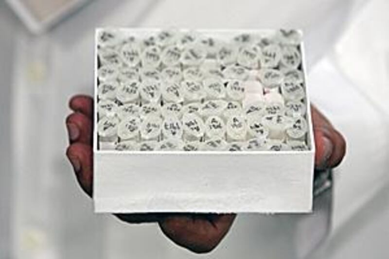 A box of DNA samples at the Dubai Cord Blood & Research Centre in Dubai.
