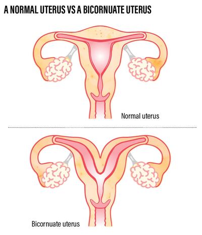Naima Haji, 38, was born with a malformed uterus. Ramon Peñas / The National 