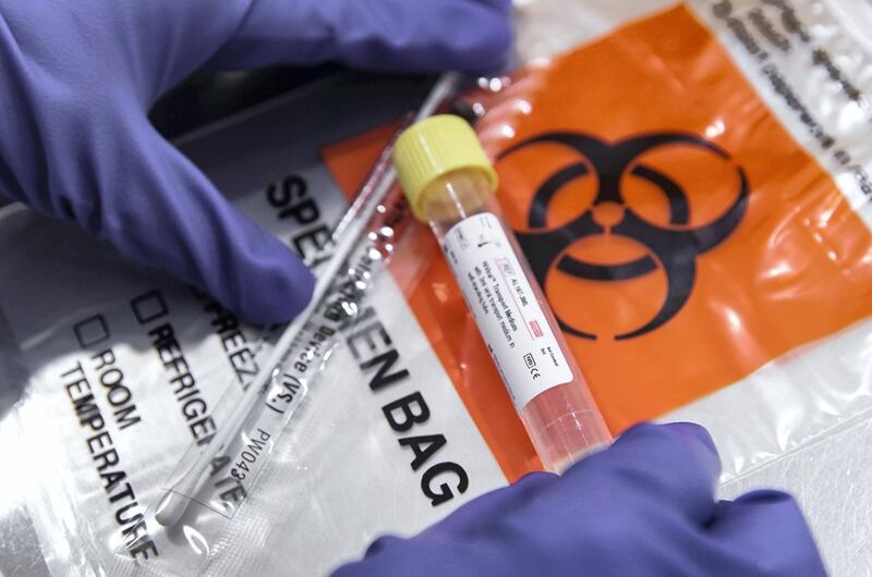 Abu Dhabi, United Arab Emirates, March 18, 2020.  
   A swab kit is prepared before a coronavirus test at the Burjeel Hospital, Abu Dhabi.
Victor Besa / The National
Reporter:  Ramola Talwar
Section:  NA