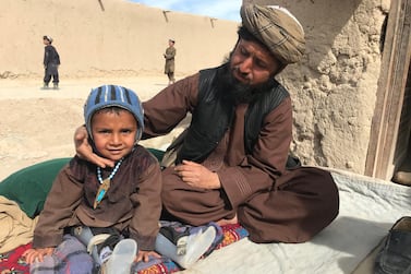 Medical workers were unable to reach Hazrat Ali's home in Kandahar during recent vaccination drives and he has since lost the use of his legs after contracting polio. Qudratullah Razwan for The National