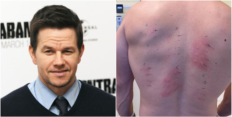 Mark Wahlberg has revealed he is allergic to 'almost everything'. Instagram / Mark Wahlberg