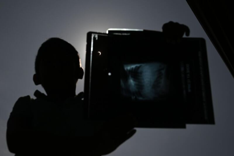 A boy holds up an X-ray he was using to view a "ring of fire" solar eclipse in Colombo.  AFP