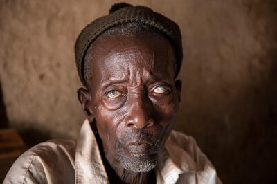 Diba Cisskho, 70, lost his eyesight to river blindness. His translucent eyes are the telltale sign of the disease, which is transmitted by black flies. The END Fund is working to eradicate river blindess in Senegal. Scenes from Tambanoumouya, Senegal where 66% of the village suffered from the disease in 1986 and today it is nearly nonexistent.