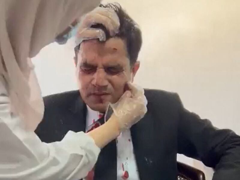 Mr Khan's lawyer receives medical attention after he was injured during his client's arrest. Reuters