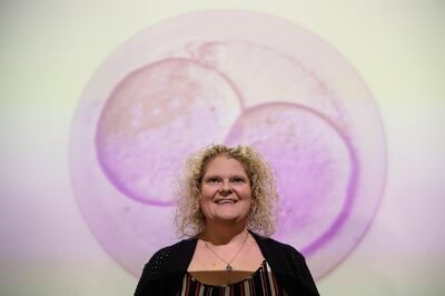 LONDON, ENGLAND - JULY 23:  Louise Brown poses for photographs following a press conference to mark her approaching fortieth birthday, at the Science Museum on July 23, 2018 in London, England. On 25th July 1978, Louise Brown became the first baby to be born using the In Vitro Fertilisation technique pioneered by British researchers Robert Edwards, Patrick Steptoe and Jean Purdy.  The Science Museum in London is holding an exhibition entitled IVF: 6 Million Babies Later to celebrate the success of IVF.  (Photo by Leon Neal/Getty Images) ***BESTPIX***