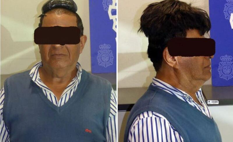 This spectacularly conspicuous attempt to smuggle €30,000 of cocaine ended in arrest for a Colombian passenger in July, 2019. The man, 65, concealed one kilo of the illicit powder by gluing it to his head. He was caught when police noticed the height of his black toupee, when his flight from Bogota landed in Barcelona. Photo: Policia Nacional