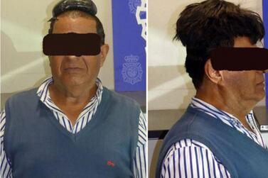 This Colombian man attempted to smuggle more than 30,000 euros worth of cocaine under his toupee. Courtesy: Policia Nacional