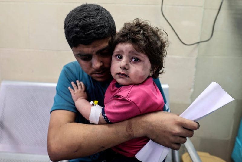TOPSHOT - A Palestinian man holds an injured girl awaiting medical care at al-Shifa hospital, after an Israeli air strike in Gaza city, on May 11, 2021. / AFP / MAHMUD HAMS
