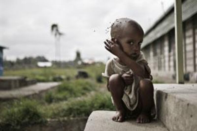 Malnourished children were among the 4.5 million Ethiopians who needed food aid during a drought in the country last year.