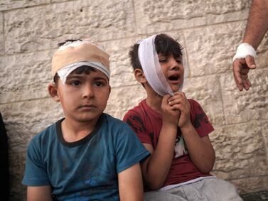 Injured Palestinian boys wait react as they wait with their families to identify the bodies of relatives killed in Israeli bombardment at Al-Aqsa Martyrs Hospital in Deir al-Balah. AFP