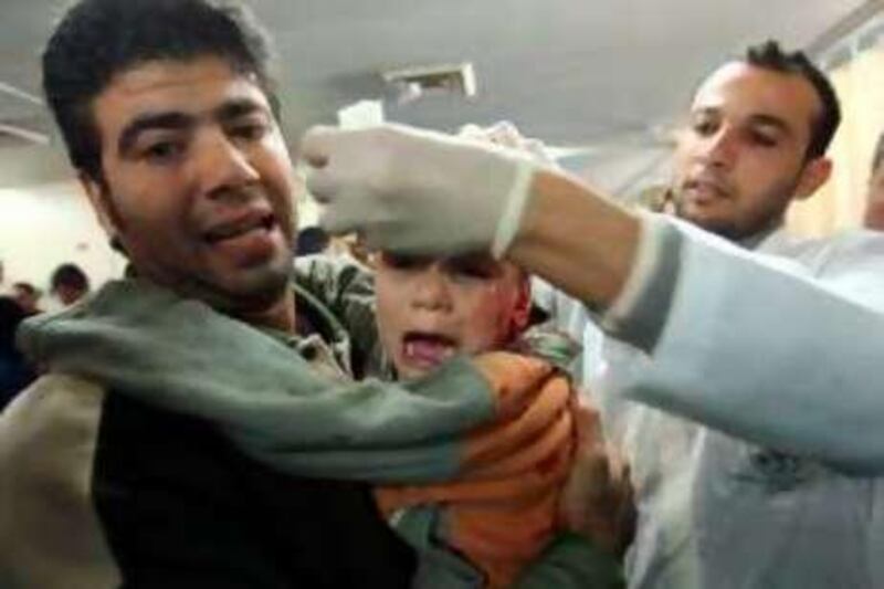 A wounded Palestinian boy is carried by his father at a hospital in Gaza City following an Israeli air strike on December 28, 2008. Israel warned today it could send ground troops into Gaza as its warplanes continued pounding Hamas targets inside the enclave where more than 270 Palestinians have been killed in just 24 hours. AFP PHOTO/MOHAMMED ABED *** Local Caption ***  980057-01-08.jpg