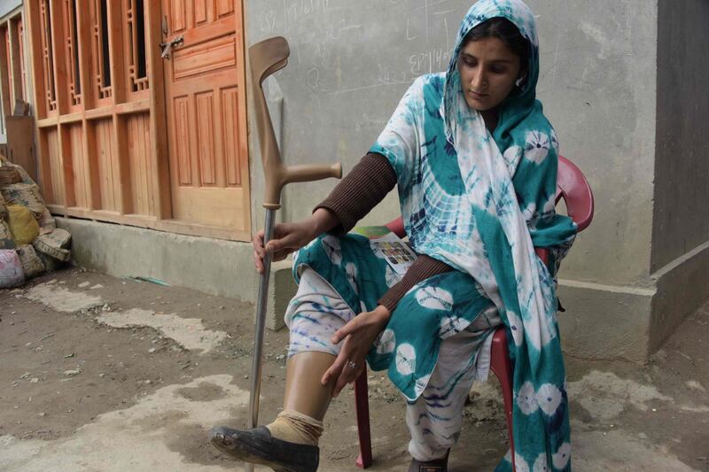 This picture taken on February 27, 2018 shows Pakistani Kashmiri Salima Bibi, 24, a victim of landmine, wearing an artificial limb before giving an awareness campaign for landmines talk to local residents at a village in Neelum Valley on the Line of Control in Pakistan-controlled Kashmir. Laid by troops along both sides of the highly militarised Line of Control (LoC), the de-facto border dividing the contested Himalayan region between India and Pakistan, landmines are believed to kill and maim dozens of villagers each year. - TO GO WITH Pakistan-Kashmir-mines,FEATURE by Sajjad QAYYUM
 / AFP / SAJJAD QAYYUM / TO GO WITH Pakistan-Kashmir-mines,FEATURE by Sajjad QAYYUM
