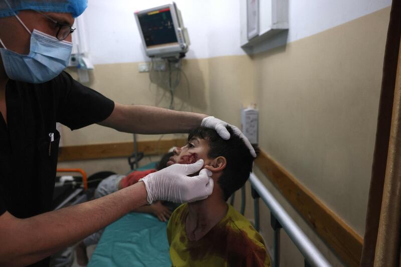 A Palestinian boy receives medical care at a hospital in the northern Gaza Strip. Nine people were killed amid air raids in the Gaza Strip, local authorities said. It was unclear whether the deaths were caused by the air strikes. Israel said it bombed Hamas targets in Gaza in response to rocket fire directed towards Israel. AFP
