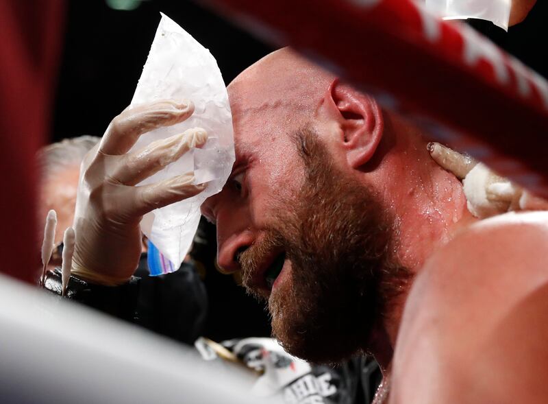 Tyson Fury receives  attention in his corner. Reuters