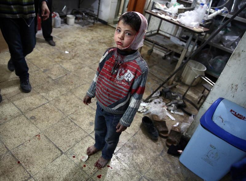 A wounded Syrian child at a makeshift hospital in the rebel-held area of Douma, east of the capital Damascus, as victims of several reported air strikes on the city are brought in by rescue teams on April 22, 2015. ABD Doumay / AFP  