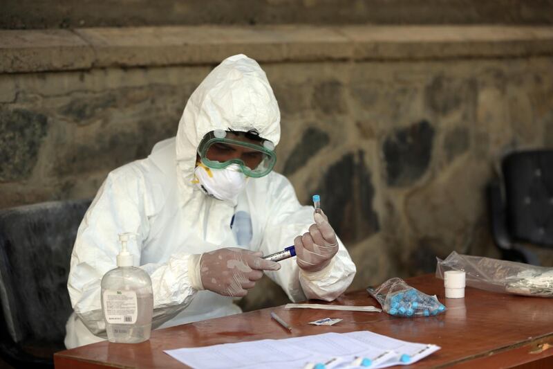 An Afghan lab technician processes a test sample for the coronavirus at the Afghan-Japan Communicable Disease Hospital, Kabul’s main facility for coronavirus testing and treatment. AP