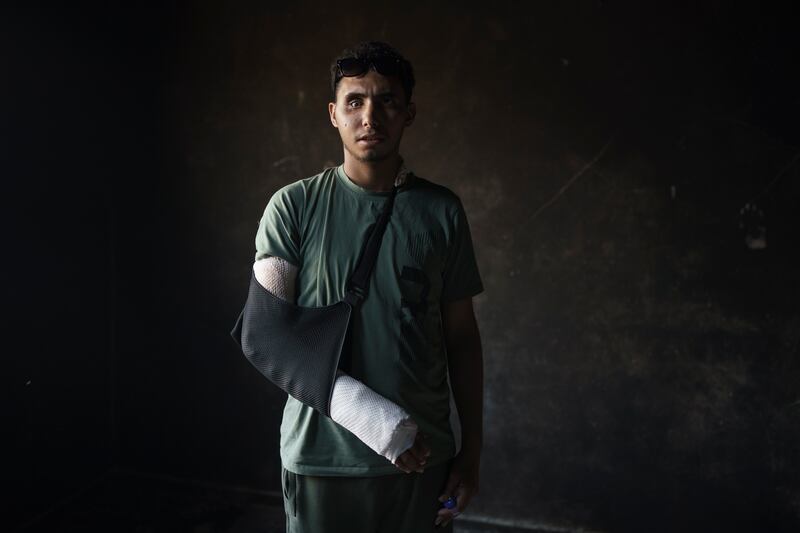 Mohamed Al Masri was injured in the 11-day war between Hamas and Israel. AP