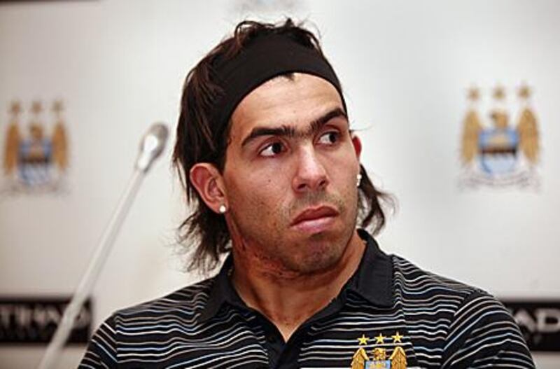 Carlos Tevez has been recovering from a heel injury.