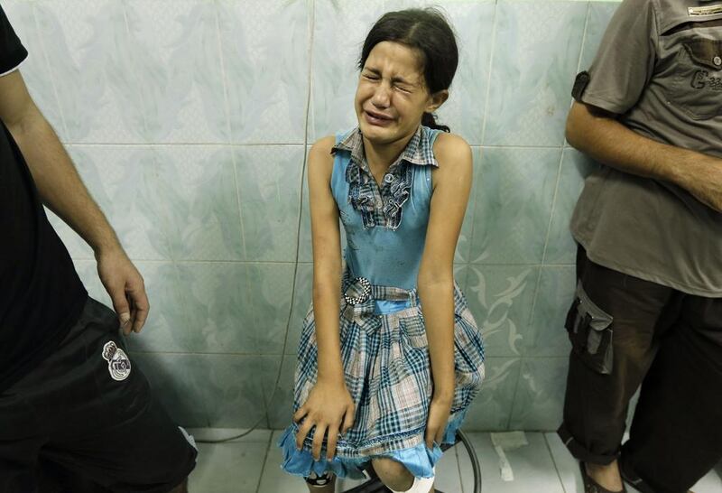 A Palestinian girl, wounded during the shelling. Mohammed Abed / AFP Photo 