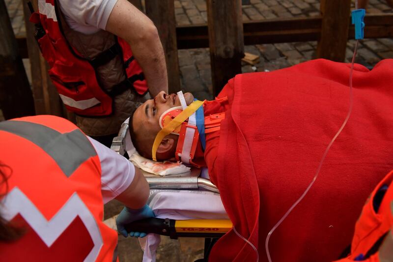 A participant lies on a stretcher after getting hurt during the affray.  Alvaro Barrientos / AP Photo