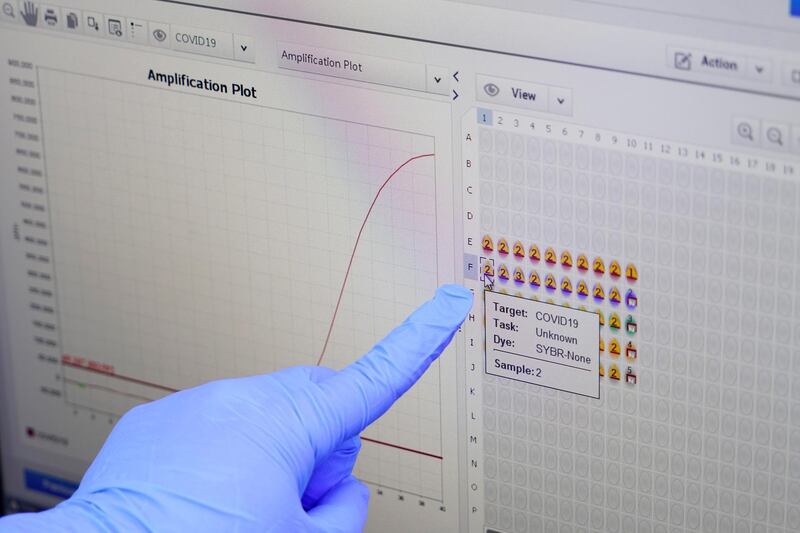 A researcher shows a result of coronavirus-positive case as she demonstrates samples of iLAMP Novel-Coronavirus Detection Kit at an iONEBIO's office in Seongnam, South Korea. Reuters