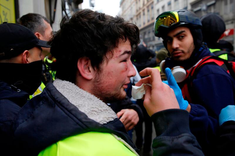 A protester with blood stains on his face treats his injury during an anti-government demonstration called by the "yellow vests" (gilets jaunes) movement, on February 9, 2019 in Lyon. The "Yellow Vests" (Gilets Jaunes) movement in France originally started as a protest about planned fuel hikes but has morphed into a mass protest against the French President's policies and top-down style of governing. / AFP / ALEX MARTIN
