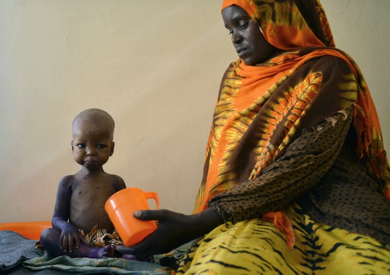 A malnourished child is fed a special formula by her mother at a hospital in Somalia.