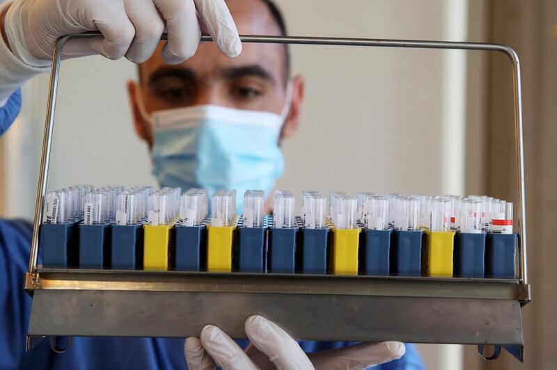A laboratory worker looks at PCR tests at the CHU de Liege hospital in Liege, Belgium. Reuters