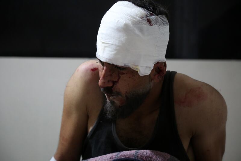 A man who was injured after shells fell on a neighbourhood near Aleppo on January 1. EPA