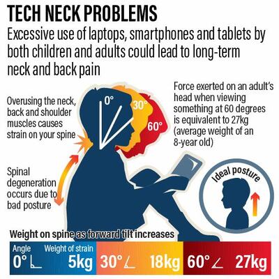 Tech-neck can lead to spinal degeneration