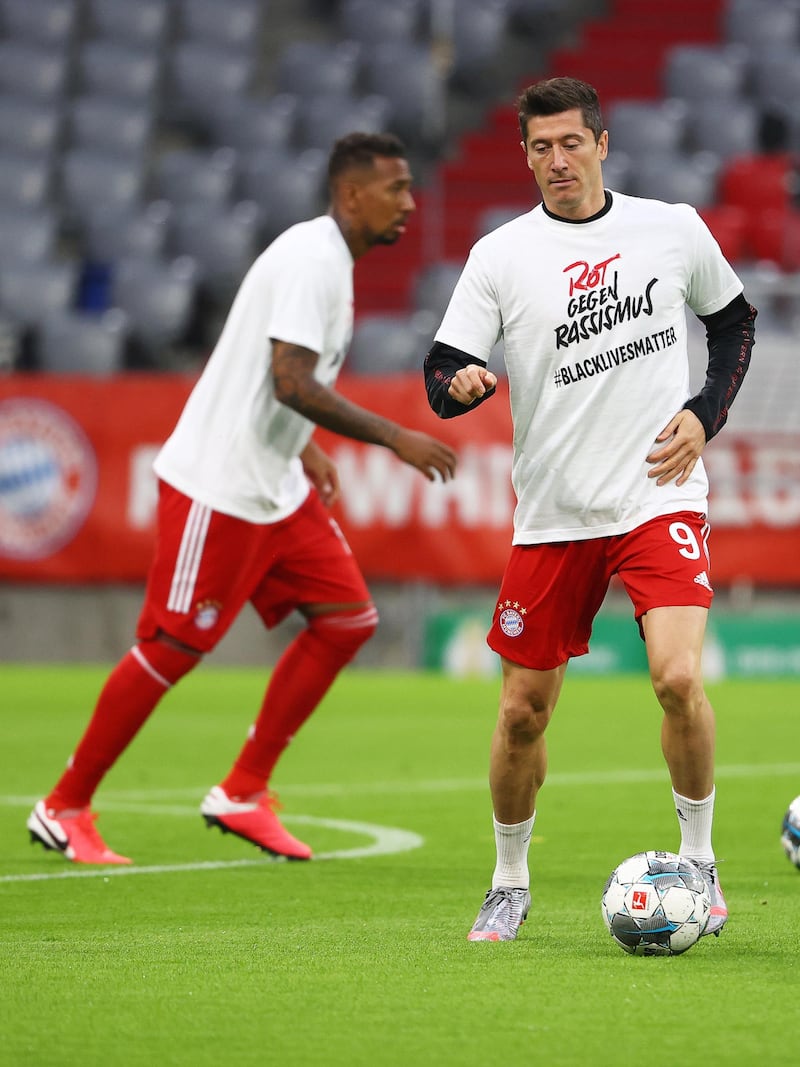 Bayern striker Robert Lewandowski prepares for the game. EPA