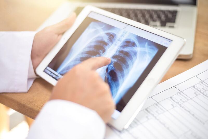 closeup of a young caucasian doctor man sitting at his office desk observing a chest radiograph in a tablet computer