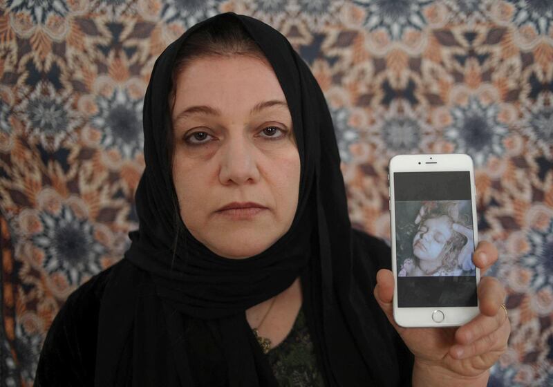 Alwand Ali, 39, one of the victims of the Halabja Chemical attack in 1988, displays her picture following the attack as she poses in the Kurdish town, 300 kms (190 miles) northeast of Baghdad. AFP