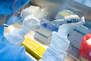 A scientist prepares samples during the research and development of a vaccine against the coronavirus disease at a laboratory of BIOCAD biotechnology company in Saint Petersburg, Russia. Reuters