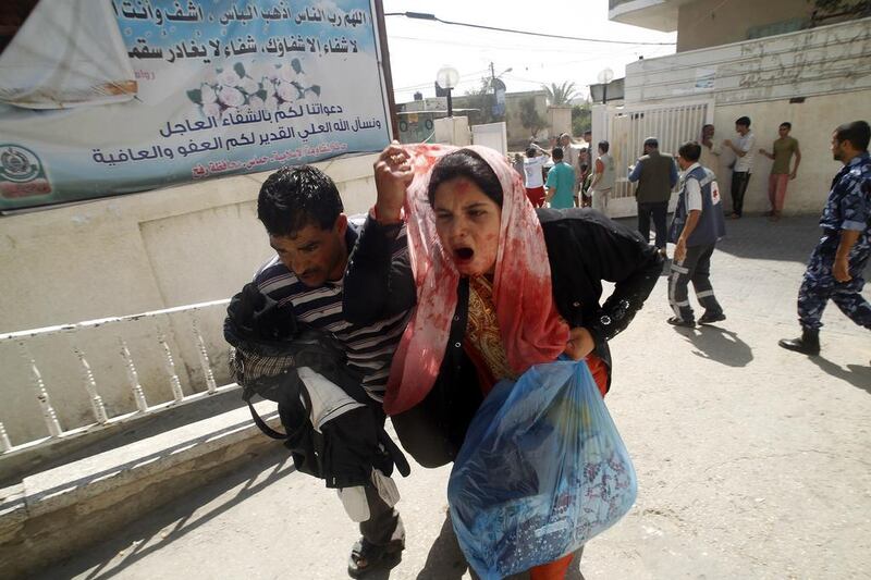 A wounded Palestinian woman arrives at Al Najar hospital in the southern Gaza strip after Israeli shelling of Rafah on August 1, 2014. Said Khatib / AFP