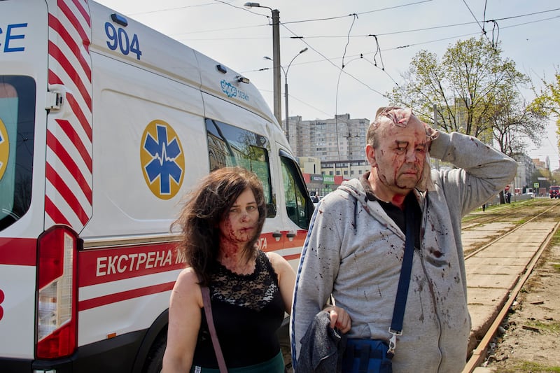 Wounded civilians await medical attention after Russian shelling in Kharkiv. EPA