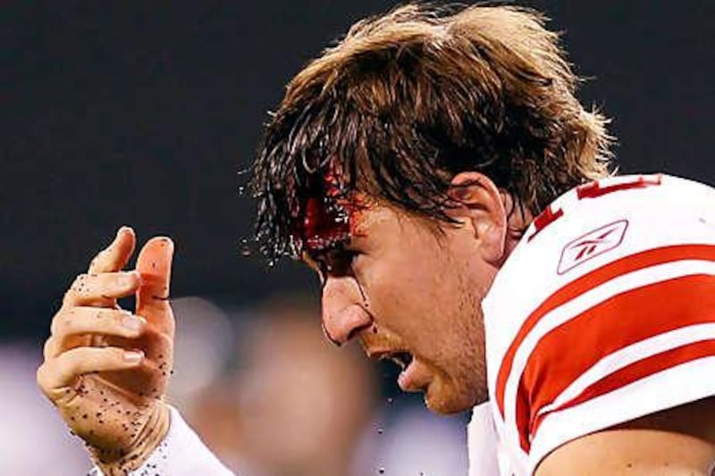 Eli Manning needed 12 stitches in the head wound he suffered against the New York Jets.