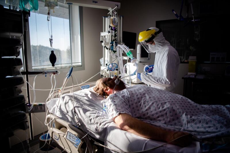 A ventilated patient with Covid-19 lies on his back at the University Hospital of Charleroi in Charleroi, Belgium. Getty Images
