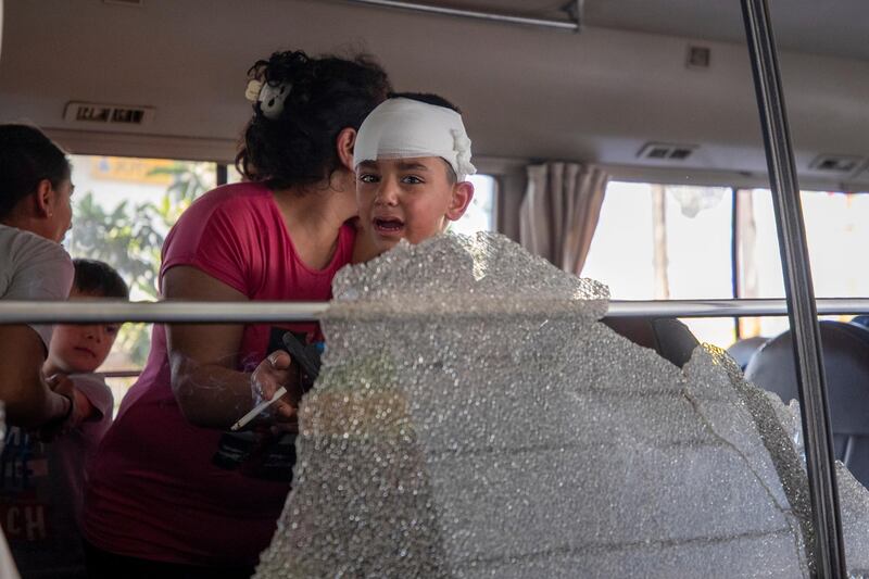 A Syrian boy cries in front of shattered glass after the bus he was on was attacked. AP Photo