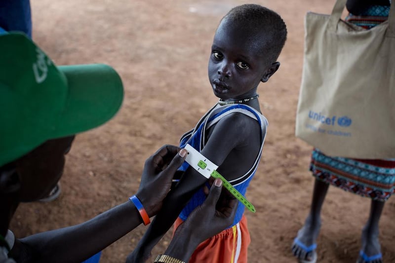 In this photo taken Thursday, Oct. 20, 2016 and released by Unicef, a boy has his arm measured to see if he is suffering from malnutrition during a nutritional assessment at an emergency medical facility supported by Unicef in Kuach, on the road to Leer, in South Sudan. The country declared famine in two counties on February 20, 2017 in two counties of South Sudan, as UN aid agencies said the calamity was 'man-made'. Kate Holt/Unicef via AP